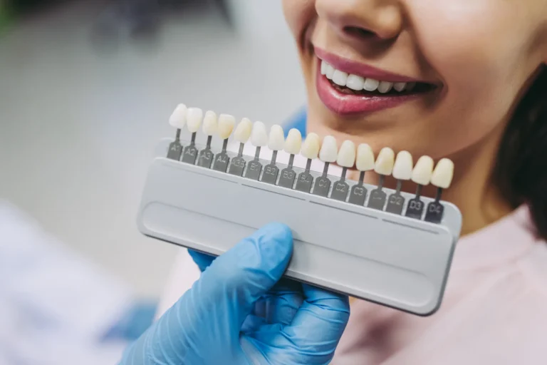 Dantų atspalvio nustatymas naudojant skalę.